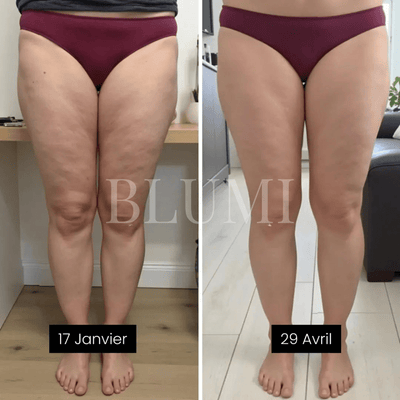 Legging Anti - Cellulite Blumi - Blumi