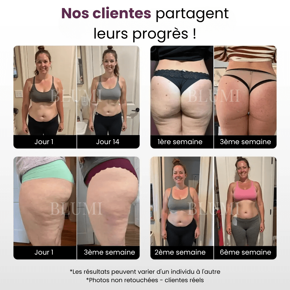 Short Anti - Cellulite Blumi - Blumi