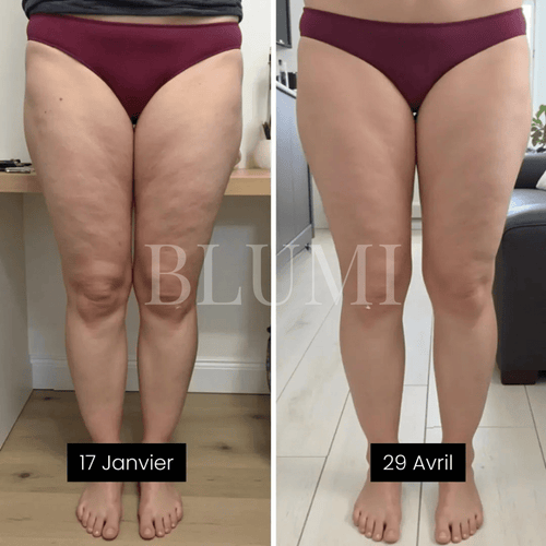 Legging Anti-Cellulite Blumi