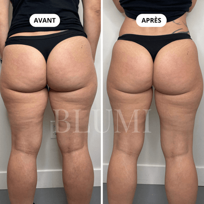 Short Anti - Cellulite Blumi - Blumi
