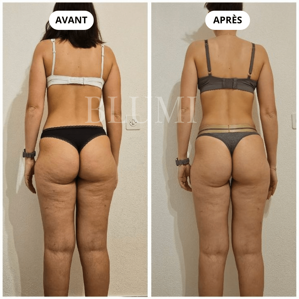 Short Anti - Cellulite Blumi - Blumi