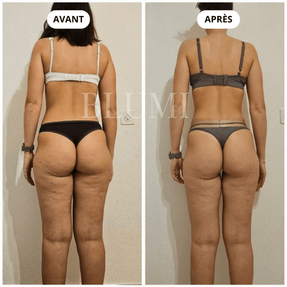 Short Anti - Cellulite Blumi - Blumi