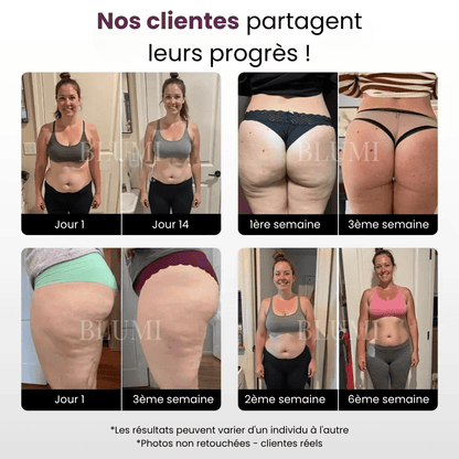 Short Anti - Cellulite Blumi - Blumi